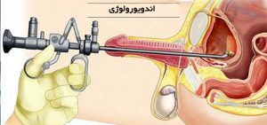 اندویورولوژی چیست